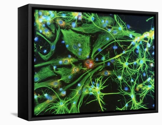 Brain Cells-Nancy Kedersha-Framed Stretched Canvas