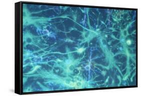 Brain Cells-Dr. Neal Scolding-Framed Stretched Canvas