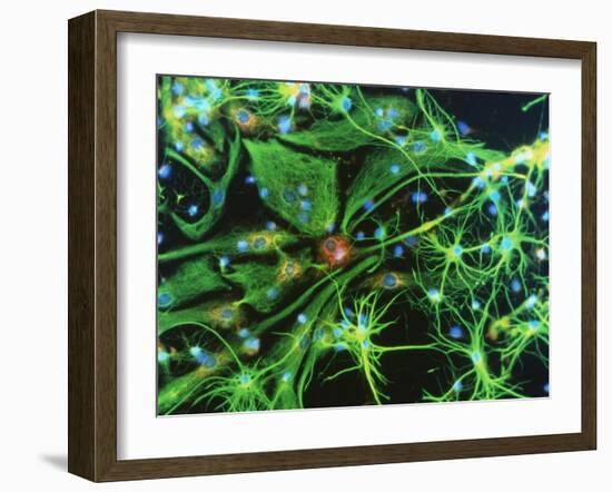 Brain Cells-Nancy Kedersha-Framed Photographic Print