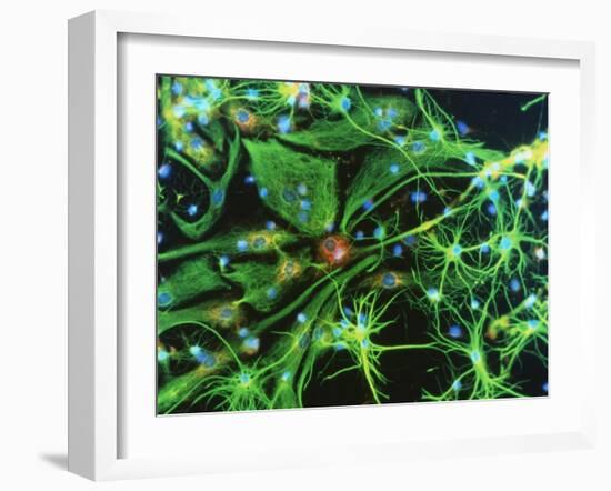 Brain Cells-Nancy Kedersha-Framed Photographic Print