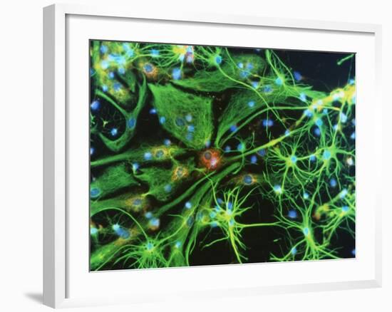 Brain Cells-Nancy Kedersha-Framed Photographic Print