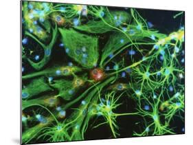 Brain Cells-Nancy Kedersha-Mounted Photographic Print