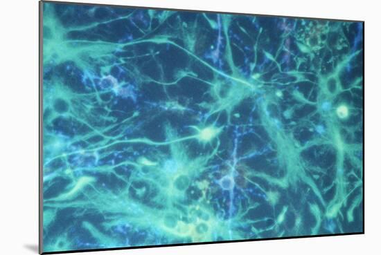 Brain Cells-Dr. Neal Scolding-Mounted Photographic Print