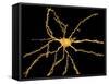 Brain Neuron-Thomas Deerinck-Framed Stretched Canvas