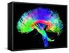 Brain Pathways-Tom-Framed Stretched Canvas