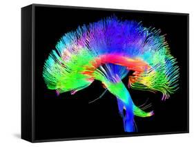 Brain Pathways-Tom-Framed Stretched Canvas