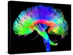 Brain Pathways-Tom-Stretched Canvas