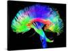 Brain Pathways-Tom-Stretched Canvas