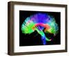 Brain Pathways-Tom-Framed Premium Photographic Print