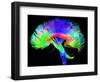 Brain Pathways-Tom-Framed Premium Photographic Print