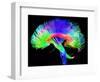 Brain Pathways-Tom-Framed Premium Photographic Print