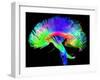 Brain Pathways-Tom-Framed Premium Photographic Print