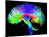 Brain Pathways-Tom-Mounted Premium Photographic Print