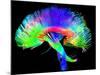 Brain Pathways-Tom-Mounted Premium Photographic Print