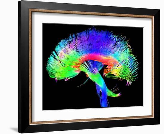 Brain Pathways-Tom-Framed Photographic Print