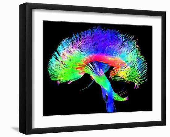 Brain Pathways-Tom-Framed Photographic Print