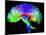 Brain Pathways-Tom-Mounted Photographic Print