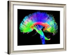 Brain Pathways-Tom-Framed Photographic Print