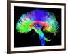 Brain Pathways-Tom-Framed Photographic Print