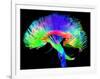 Brain Pathways-Tom-Framed Photographic Print