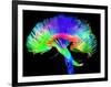 Brain Pathways-Tom-Framed Photographic Print