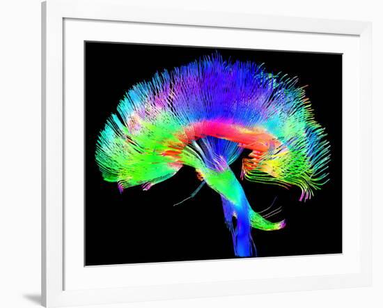 Brain Pathways-Tom-Framed Photographic Print