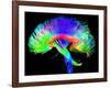 Brain Pathways-Tom-Framed Photographic Print