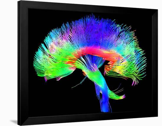 Brain Pathways-Tom-Framed Photographic Print