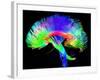 Brain Pathways-Tom-Framed Photographic Print