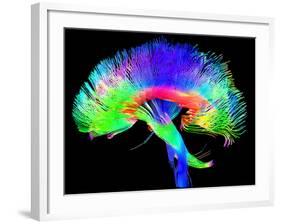 Brain Pathways-Tom-Framed Photographic Print