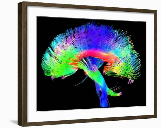 Brain Pathways-Tom-Framed Photographic Print