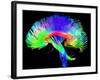 Brain Pathways-Tom-Framed Photographic Print