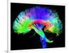 Brain Pathways-Tom-Framed Photographic Print