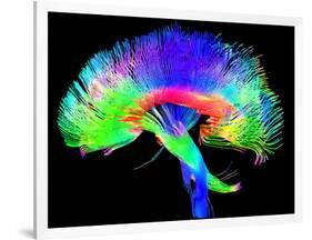 Brain Pathways-Tom-Framed Photographic Print