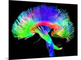 Brain Pathways-Tom-Mounted Photographic Print