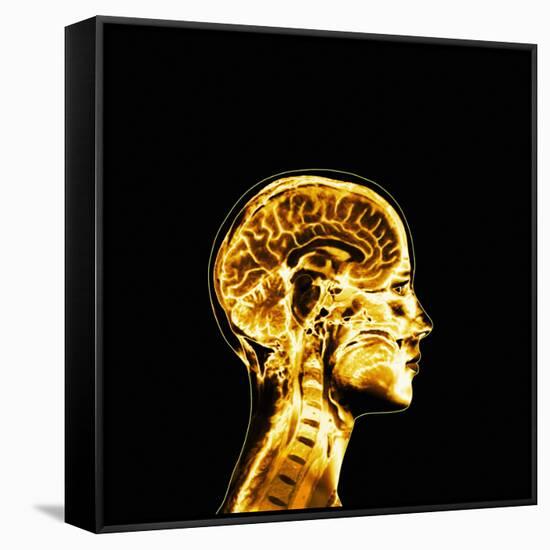Brain-Mehau Kulyk-Framed Stretched Canvas