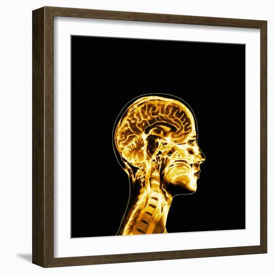 Brain-Mehau Kulyk-Framed Premium Photographic Print