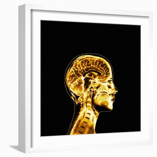 Brain-Mehau Kulyk-Framed Premium Photographic Print