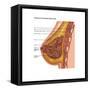 Breast Anatomy, Illustration-Gwen Shockey-Framed Stretched Canvas