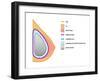 Breast Implants and Cancer-Science Source-Framed Giclee Print