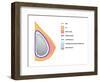 Breast Implants and Cancer-Science Source-Framed Giclee Print