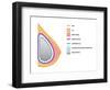 Breast Implants and Cancer-Science Source-Framed Giclee Print