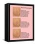 Breast Self Examination-Gwen Shockey-Framed Stretched Canvas