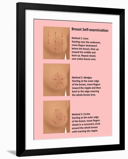 Breast Self Examination-Gwen Shockey-Framed Giclee Print