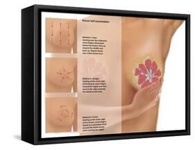 Breast Self Examination-Gwen Shockey-Framed Stretched Canvas