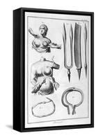 Breast Surgery, 1751-1777-Denis Diderot-Framed Stretched Canvas