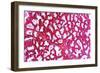 Breast Tissue, Light Micrograph-Dr. Keith Wheeler-Framed Photographic Print