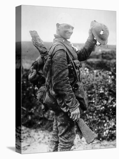 British Soldier with Bandaged Head Shows the Steel Helmet That Saved His Li-English Photographer-Stretched Canvas