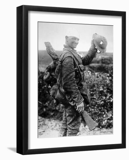 British Soldier with Bandaged Head Shows the Steel Helmet That Saved His Li-English Photographer-Framed Photographic Print