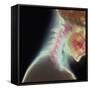 Broken Neck-Science Photo Library-Framed Stretched Canvas